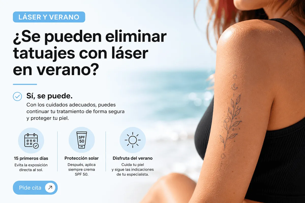 Laser tattoo removal in summer