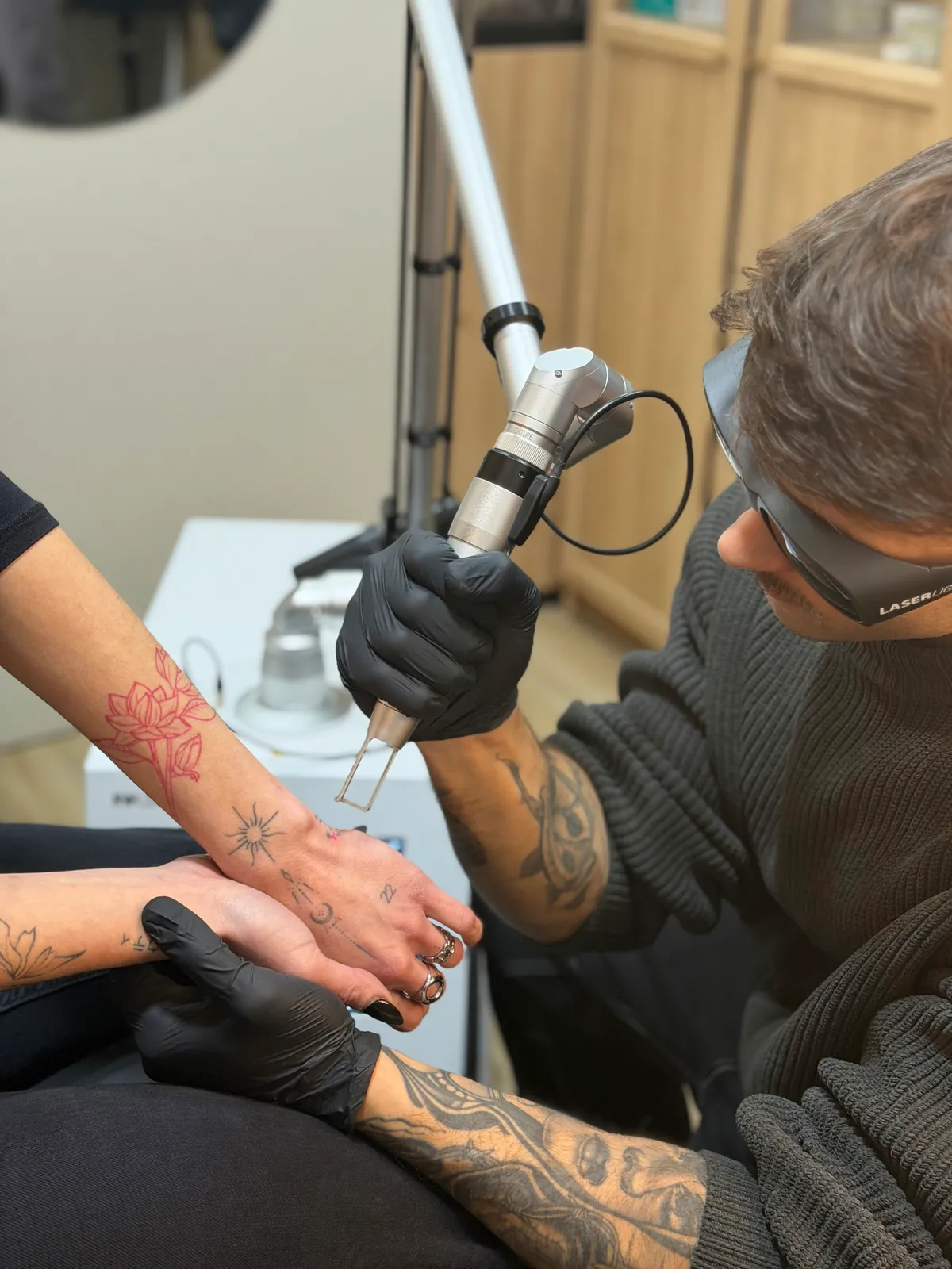 Benefits of laser tattoo removal