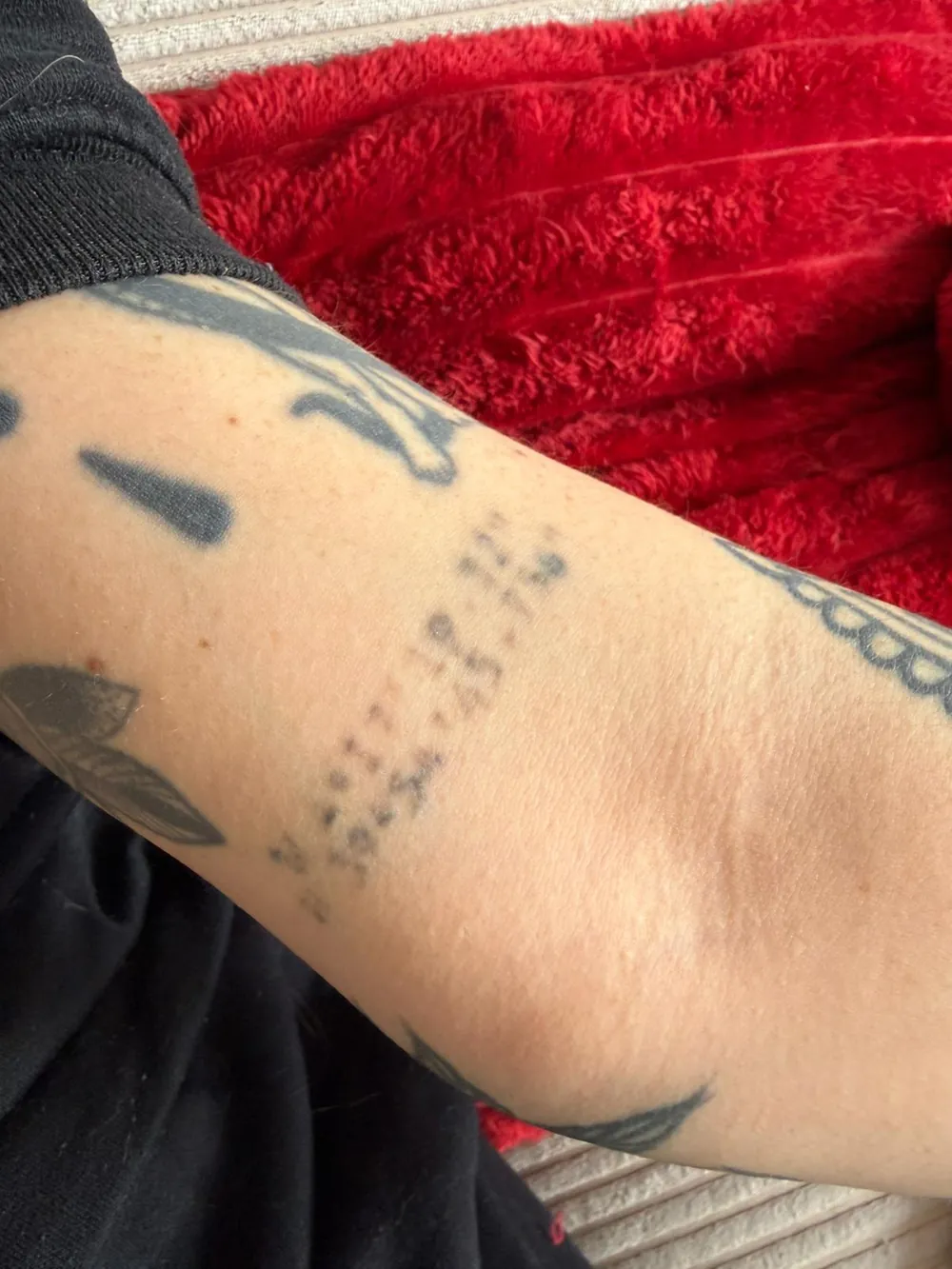 Tattoo before treatment