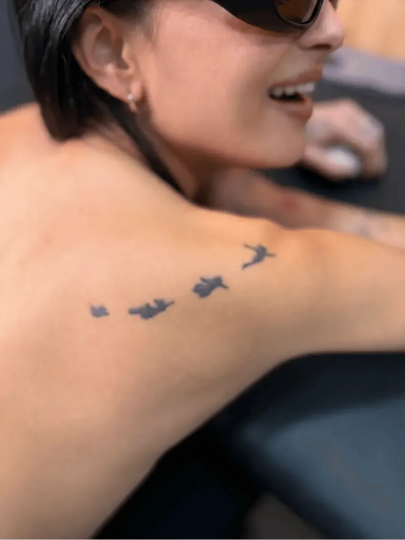 Progressive laser removal